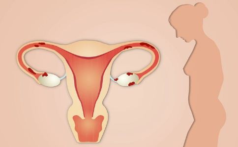 堕胎后都需要注意预防子宫感染